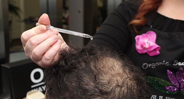 Professional-Organic-Hair-Loss-Treatment