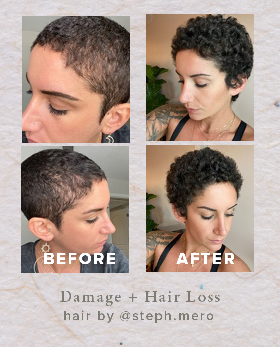 hair-loss-results